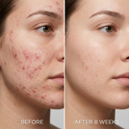 GlowVita™ Micro-Infusion Systeem