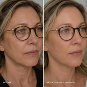GlowVita™ Micro-Infusion Systeem