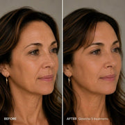GlowVita™ Micro-Infusion Systeem